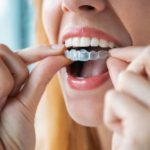 Things To Look For To Find A Trusted Dentist