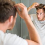 Everything You Need To Know About Hair Transplants